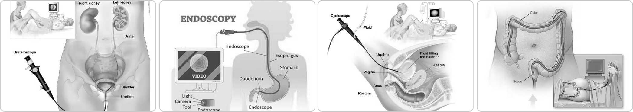 ENDOSCOPIC2.jpg